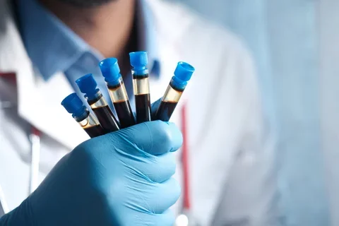 A healthcare worker wearing a white labcoat and blue gloves holds a handful of vials from a blood draw.