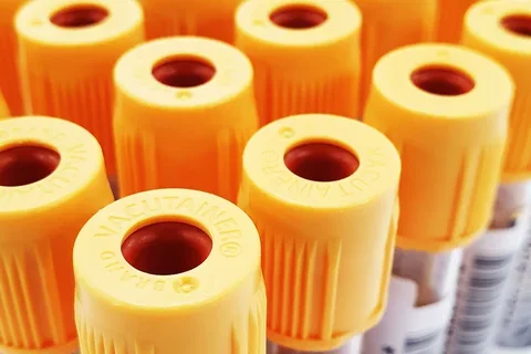 Empty vials for a blood draw.