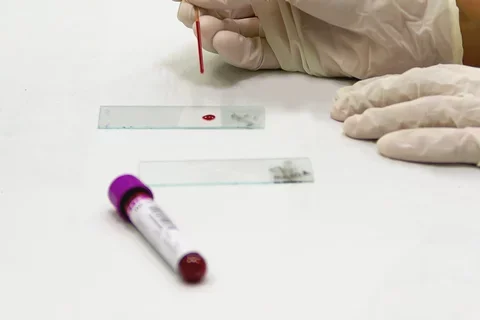 A healthcare worker wearing blue gloves prepares a microscope slide. 