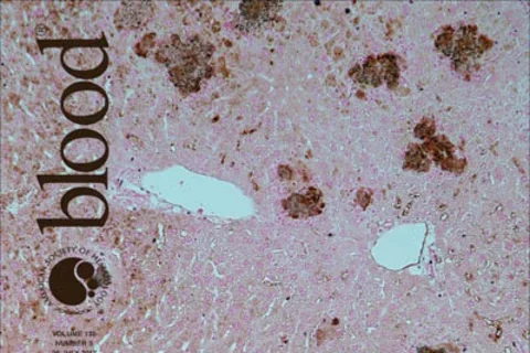 blood cover 2017 medium